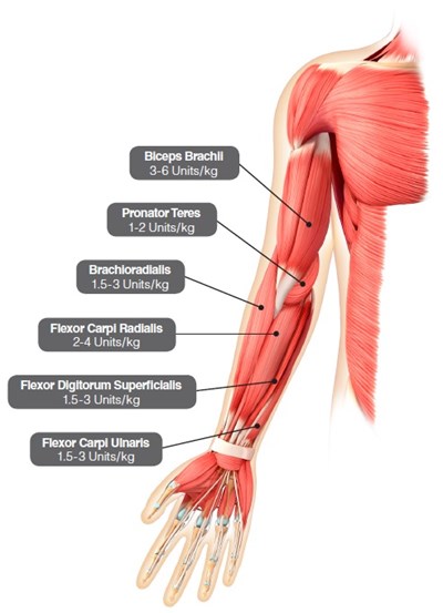 Figure 4 1